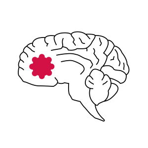 NSFs faggruppe for slagsykepleiere - logo